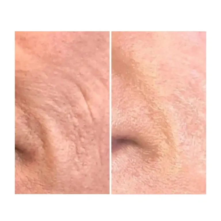 before and after pictures