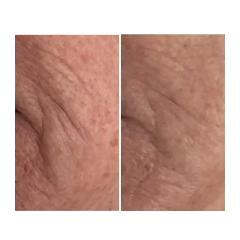 before and after pictures