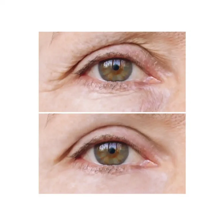 before and after pictures
