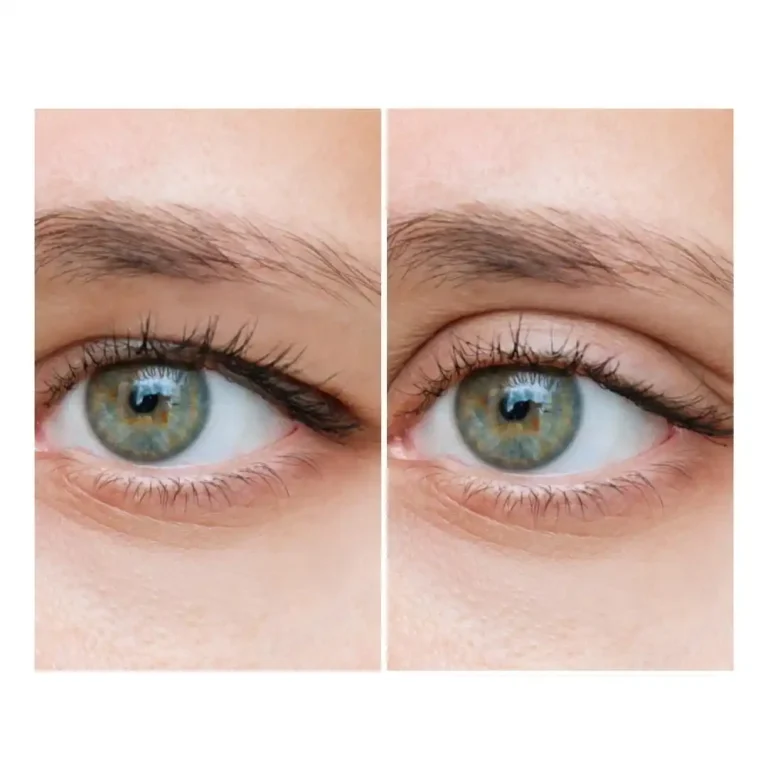 before and after pictures