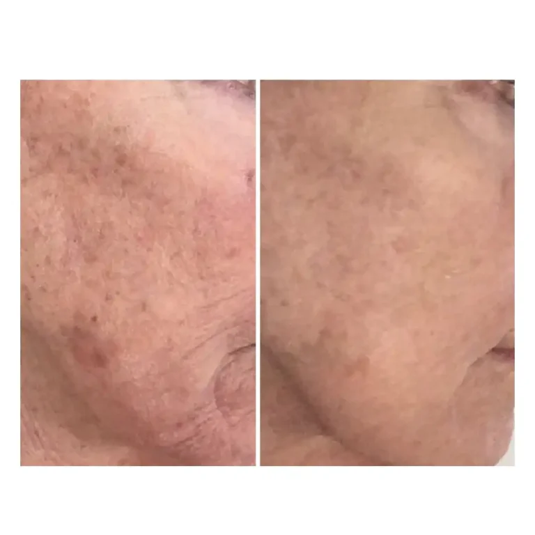 Before and after pictures