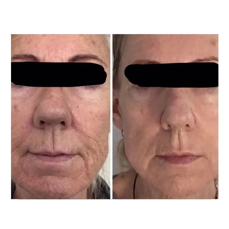 before and after pictures