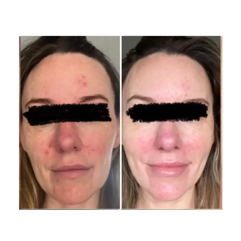 before and after pictures